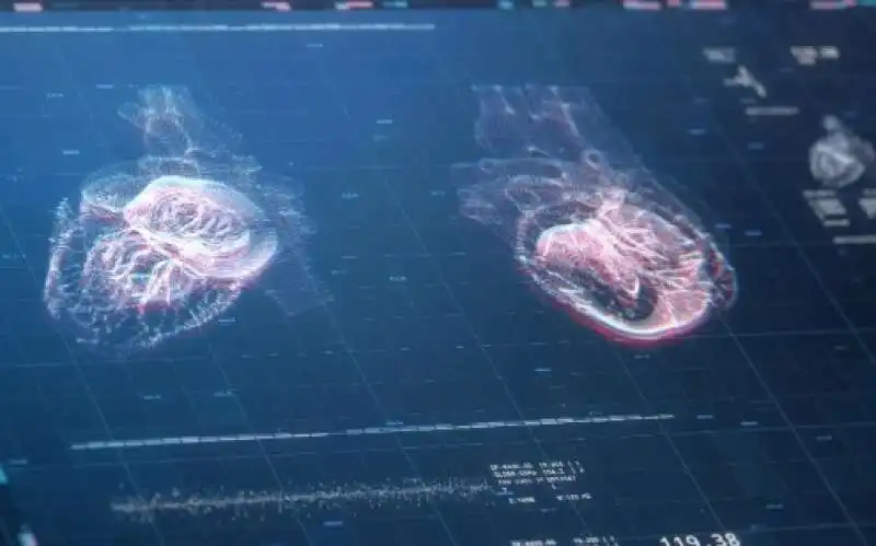 intelligenza artificiale e arresto cardiaco 2