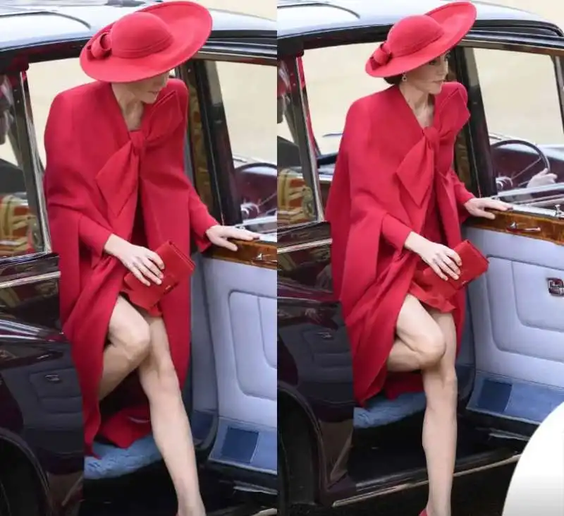 kate middleton mostra le gambe  