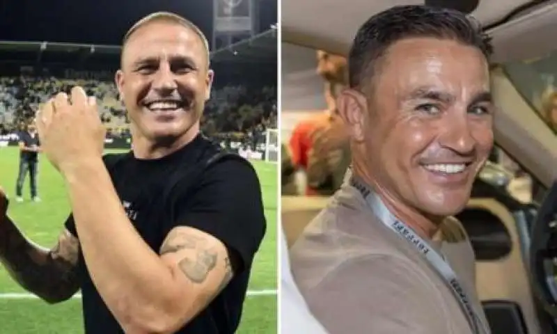 fabio cannavaro trapianto di capelli