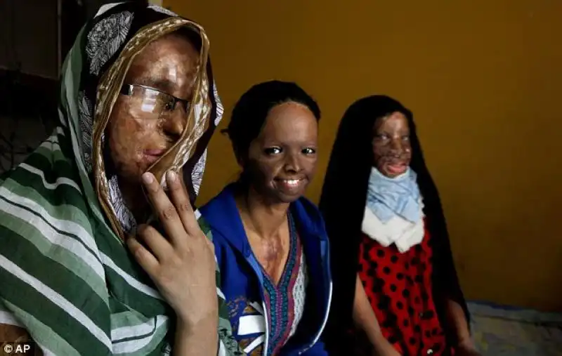 Acidificate denunciano agli uffici Stop Acid Attacks 