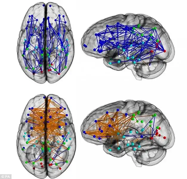 CERVELLO UOMO E CERVELLO DONNA 