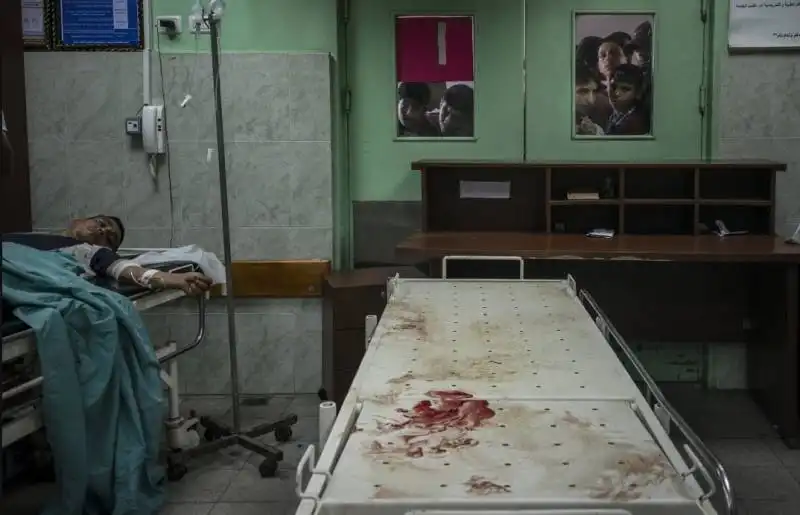 hospital’s operating room at those injured in an israeli airstrike nearby