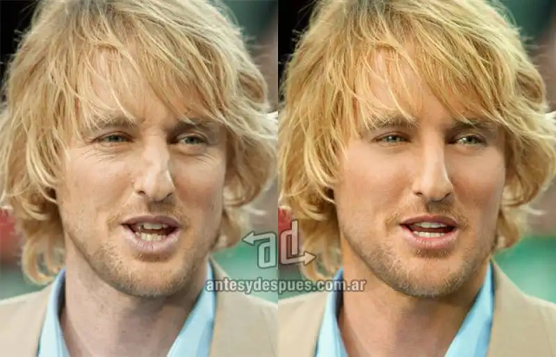 owen wilson