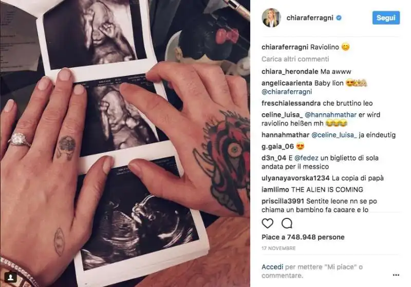 CHIARA FERRAGNI FEDEZ E LE ECOGRAFIE