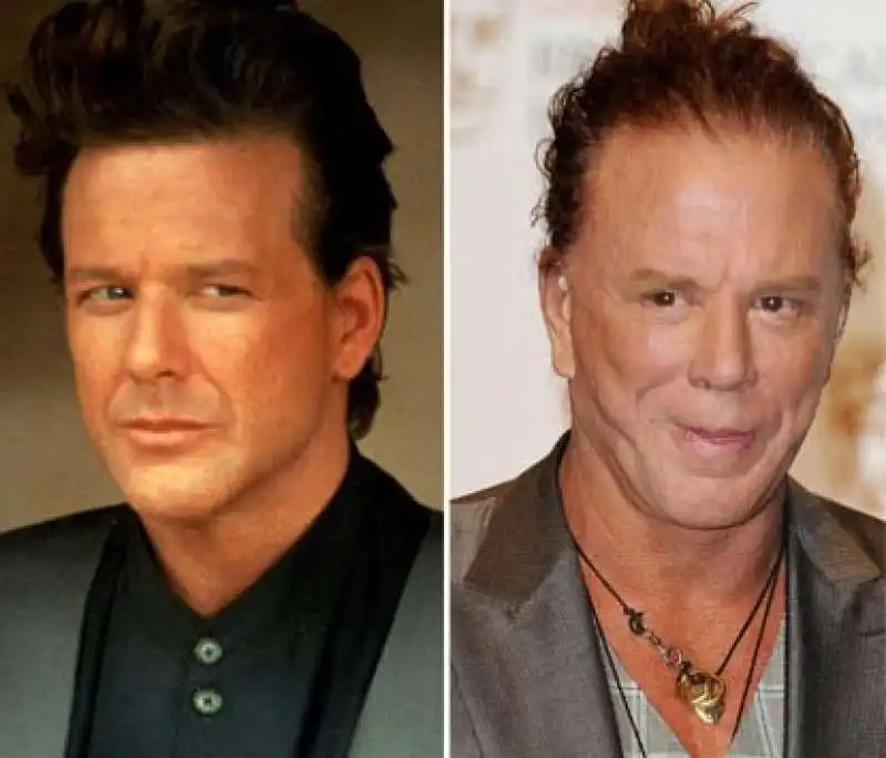 MICKEY ROURKE - PRIMA E DOPO I RITOCCHI