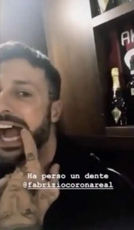 fabrizio corona perde un dente al ristorante e lo ritrova nella spazzatura 8