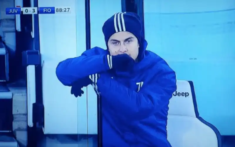 dybala