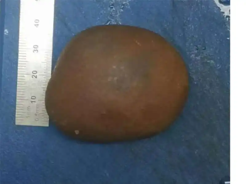 pietra calcificata