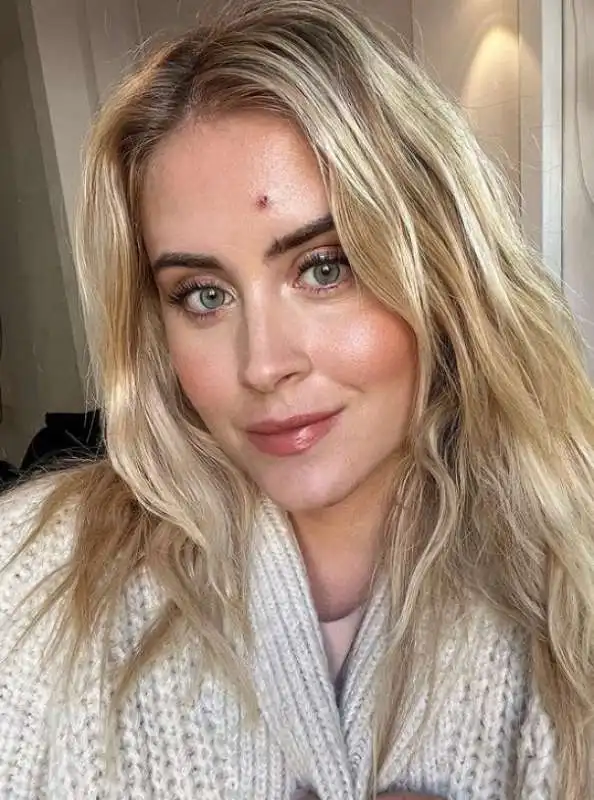 valentina ferragni e il carcinoma 7