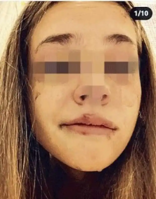 le foto pubblicate dalla 18enne picchiata dal ragazzo 