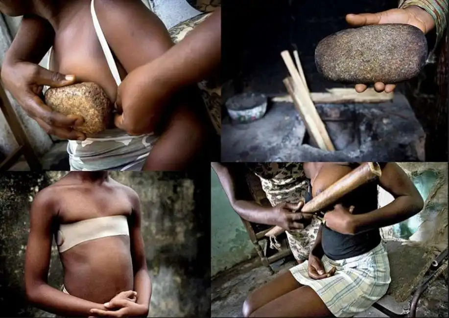 breast ironing stiramento seno