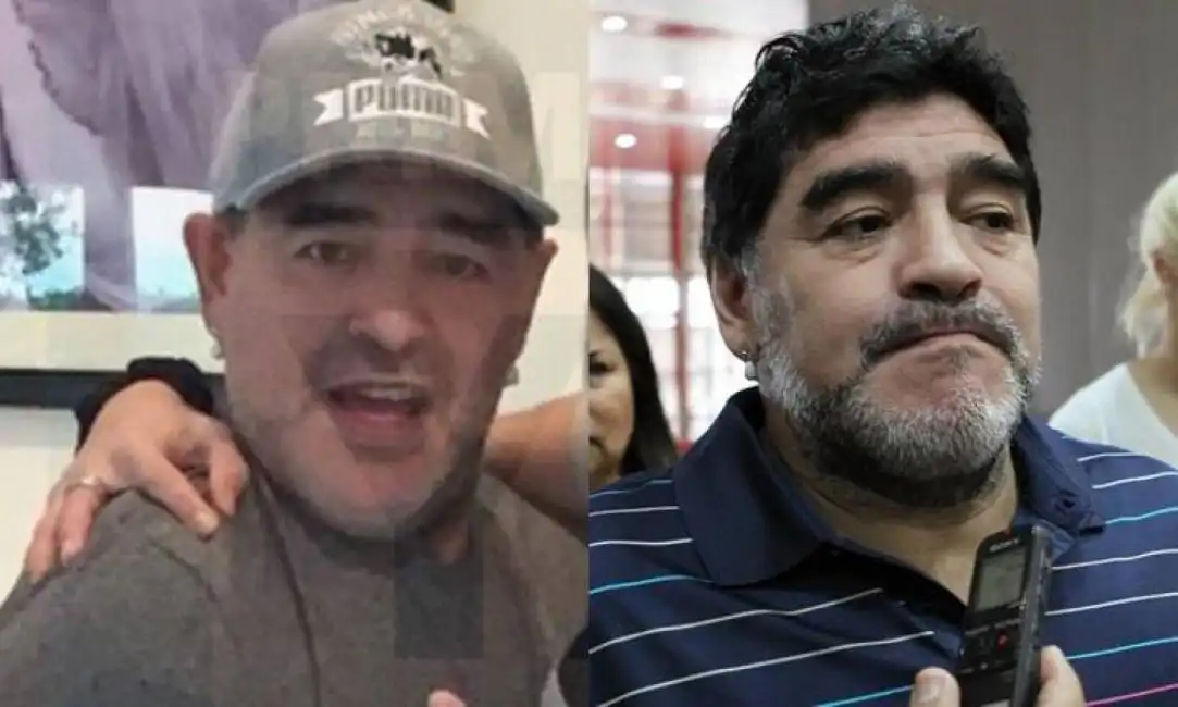 maradona - prima e dopo il lifting