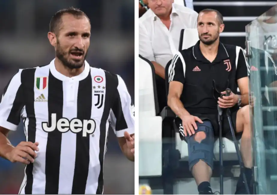 chiellini