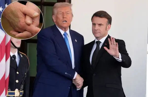 la stretta di mano tra donald trump e emmanuel macron il livido sulla mano di donald trump