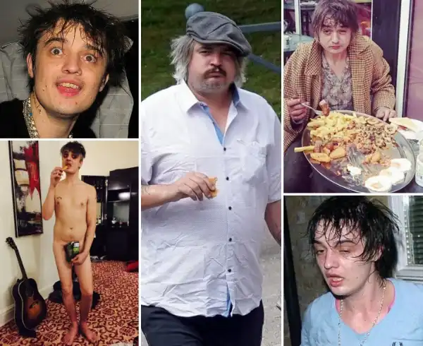 pete doherty 