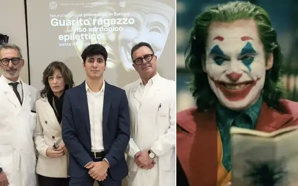 sindrome epilettica gelastica detta malattia del joker federico orlandi verona