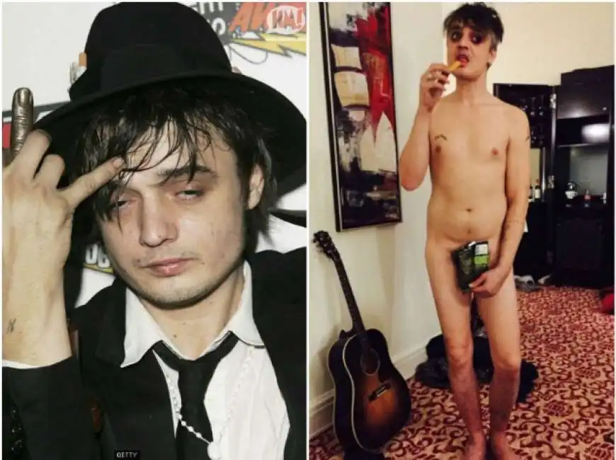 pete doherty 