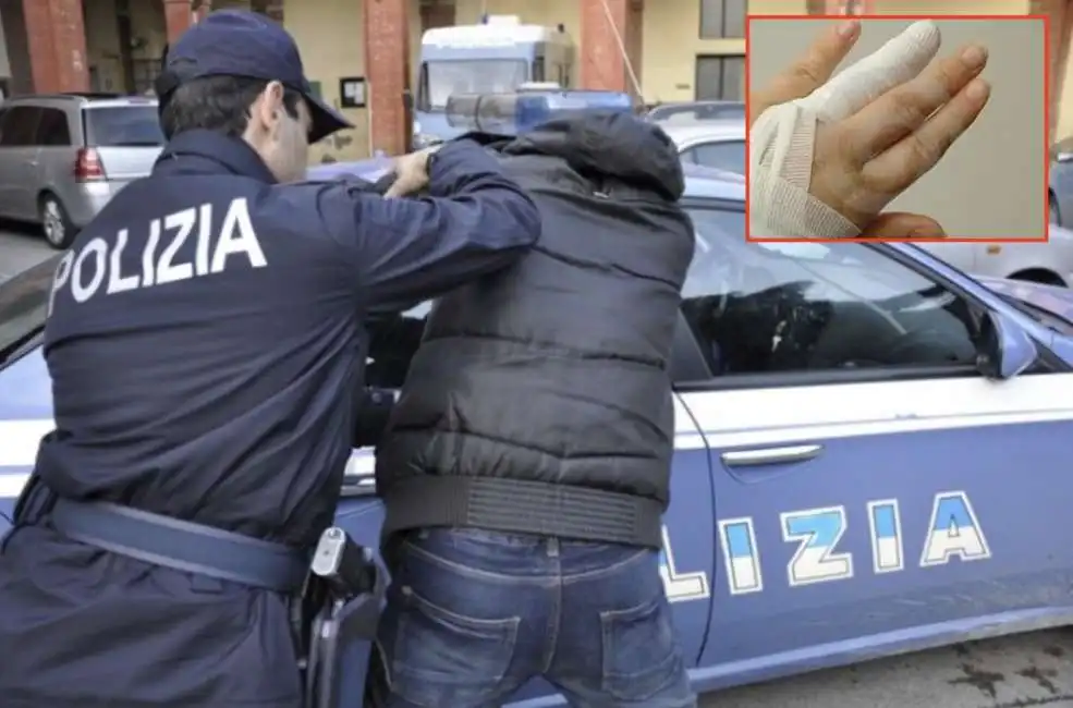 polizia poliziotto agente morso dito mano