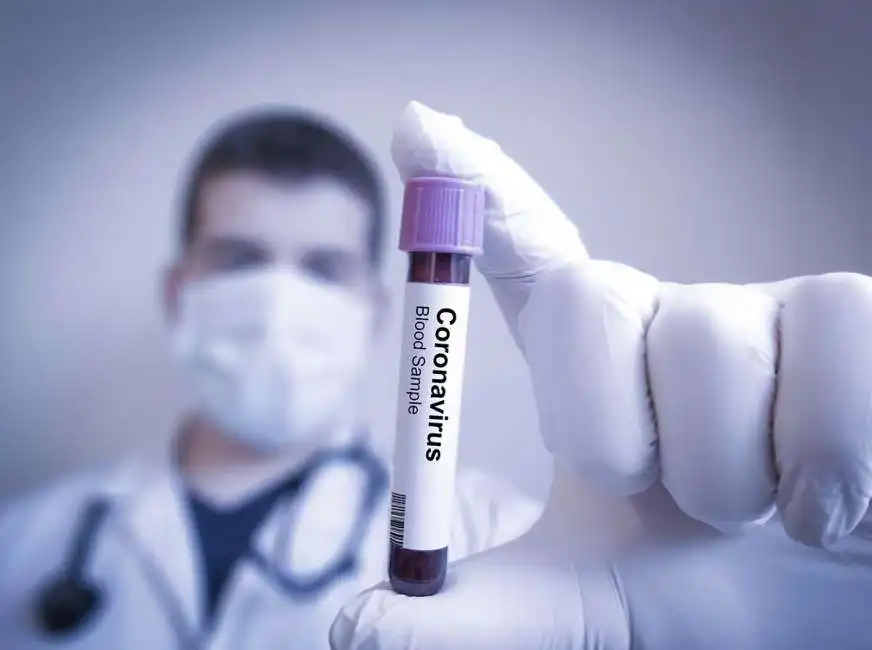 coronavirus analisi sangue