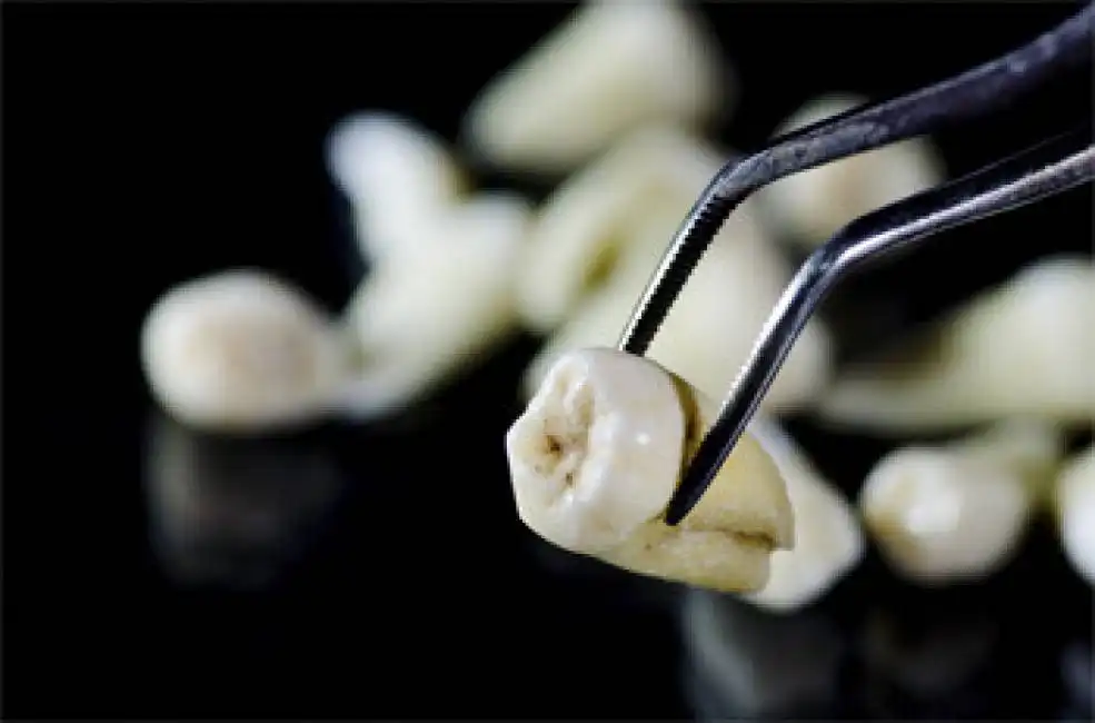 i denti spesso vengono riciclati