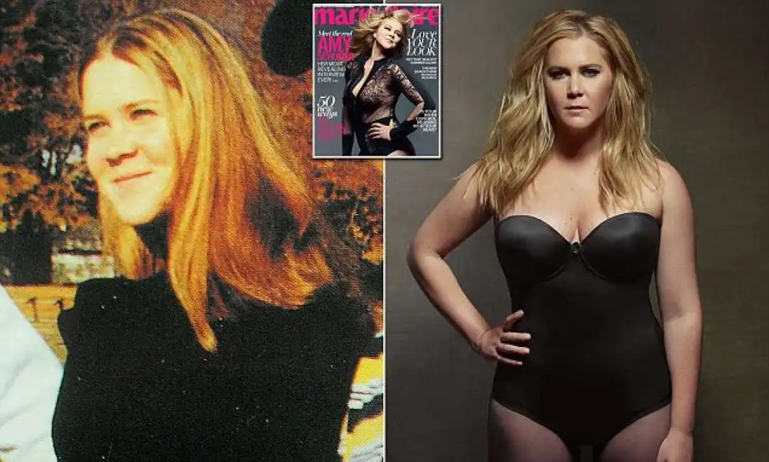 amy schumer 