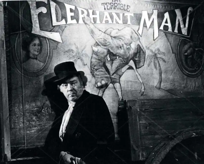 freddie jones the elephant man