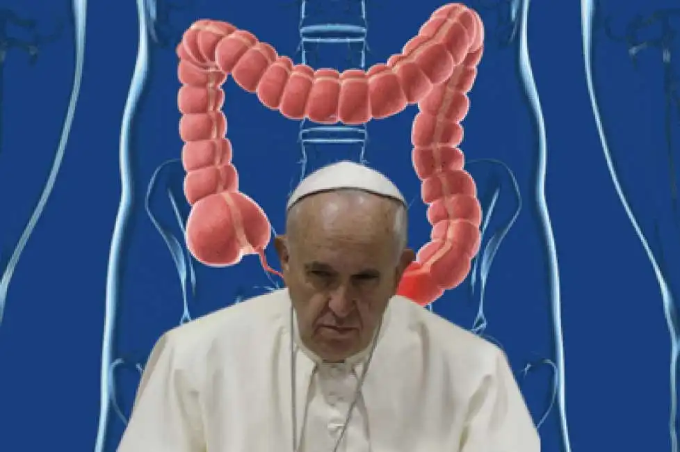 bergoglio papa francesco stenosi diverticolare colon 