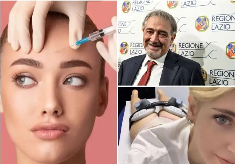 regione lazio botox lifting clinica estetica villa brasini