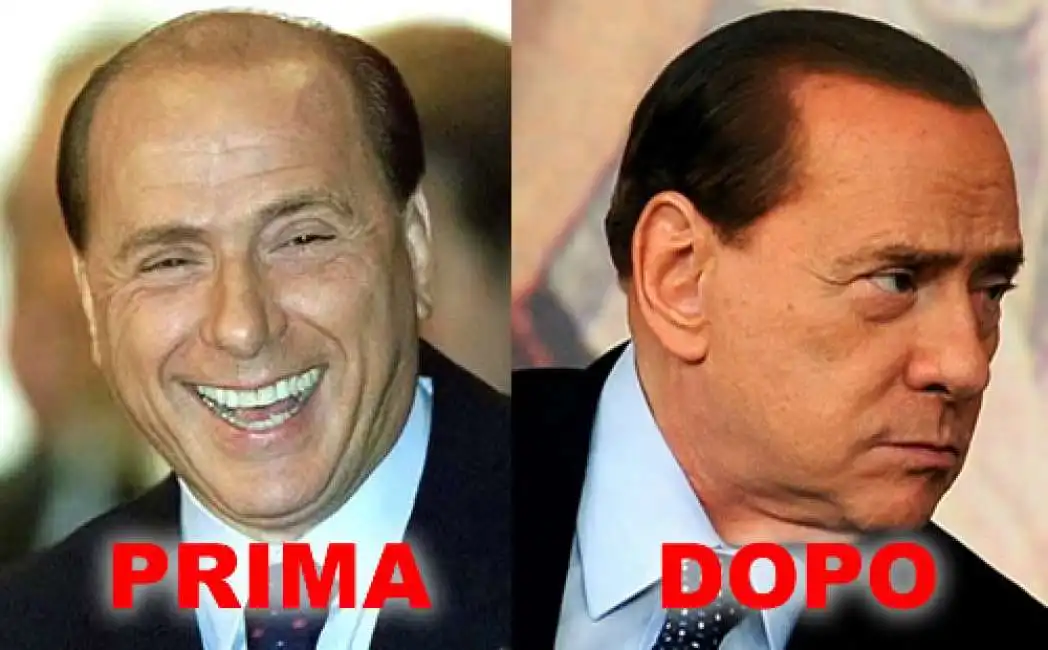 berlusconi trapianto capelli