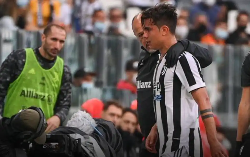 juve samp dybala