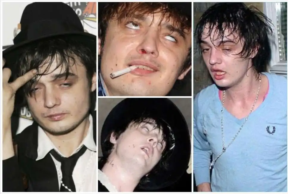 pete doherty