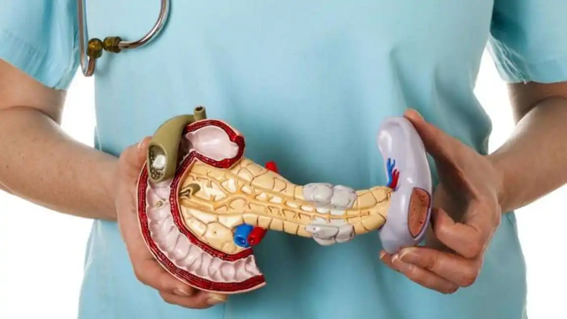 tumore al pancreas-3