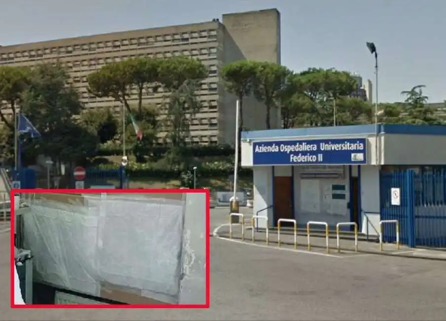 policlinico federico ii di napoli - gli spifferi coperti con i cerotti 