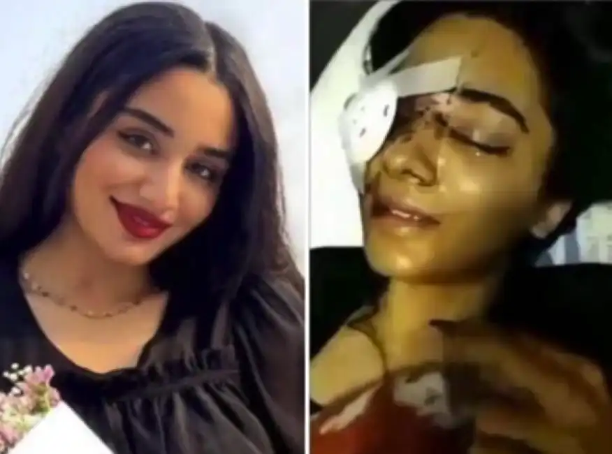 iran ragazza regime colpita da pallina cieca