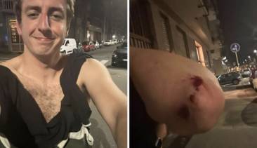 andrea joly aggredito da militanti di estrema destra a torino - 2